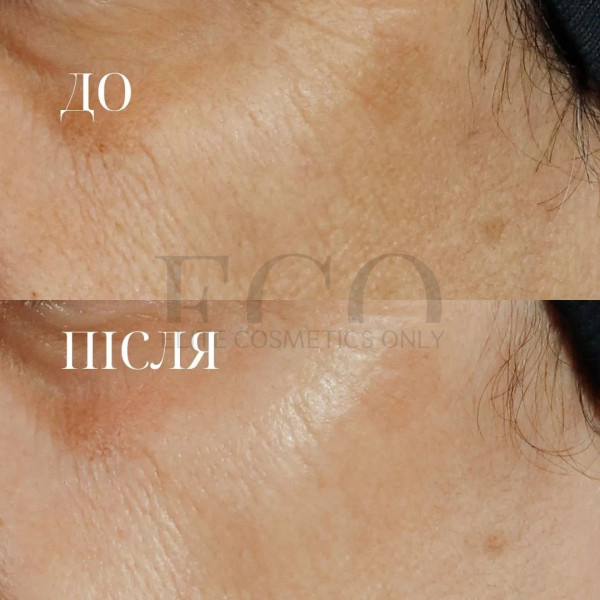 Сироватка із потрійним ретинолом Perricone MD High Potency Triple Retinol Renewal Serum, 59 мл